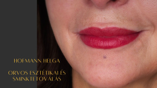 place_cover_cover_11710