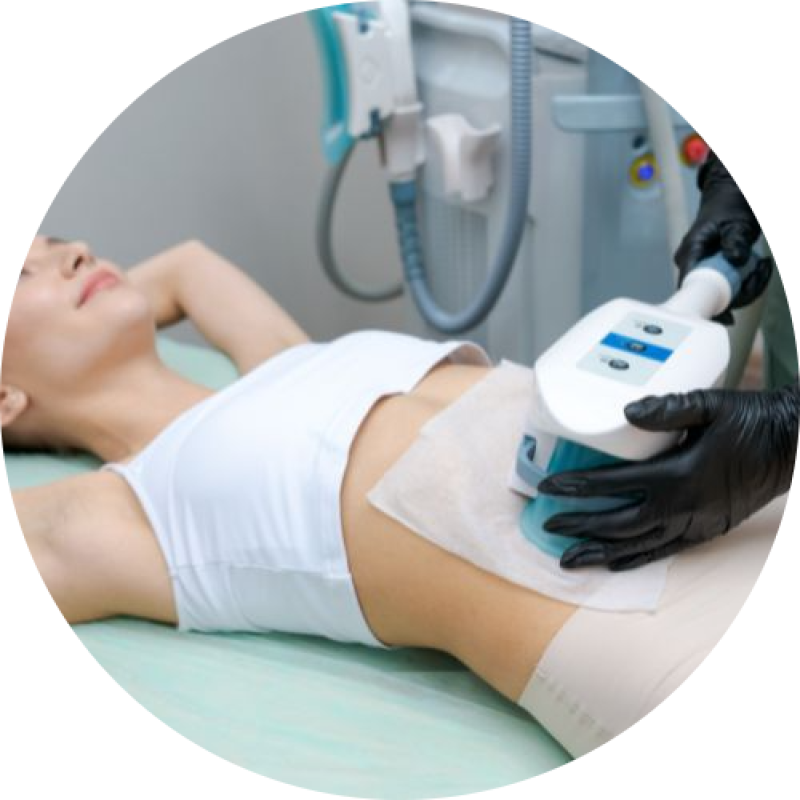 HIEMT, Kavitáció, Lipolézer