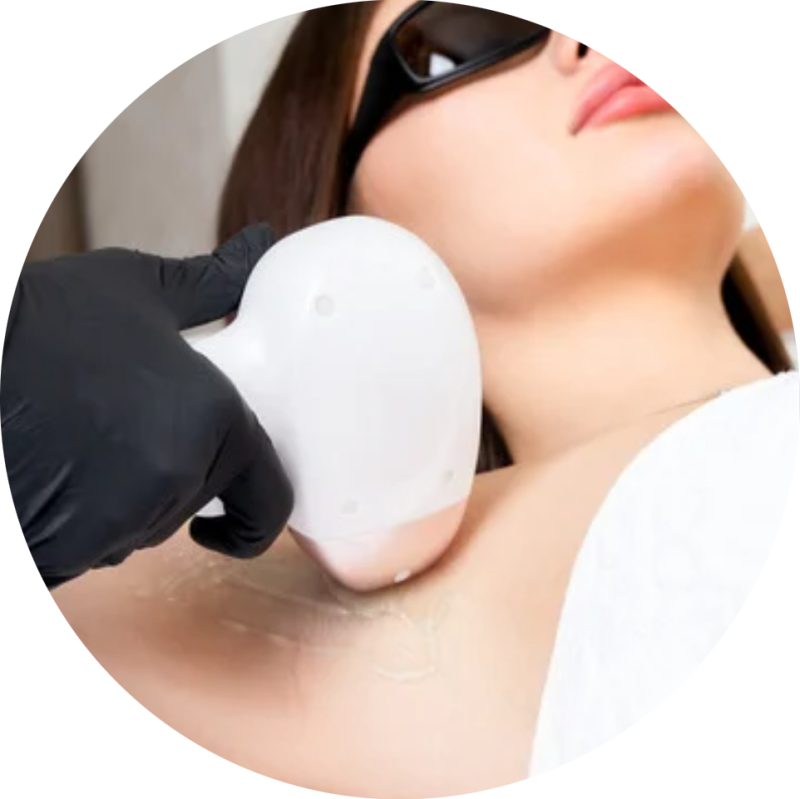 Lumenis diódalézeres szőrtelenítés