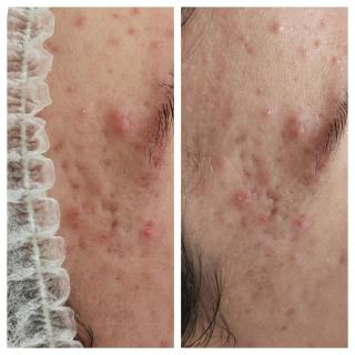 place_cover_cover_3211