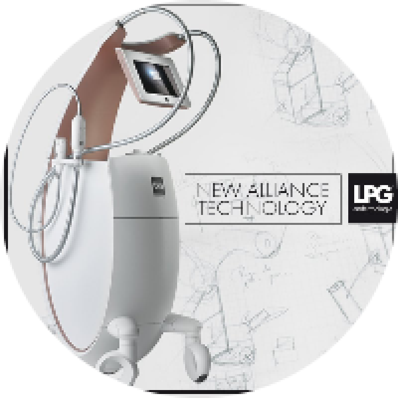 Brigi Lpg Alliance és Powershape kezelés