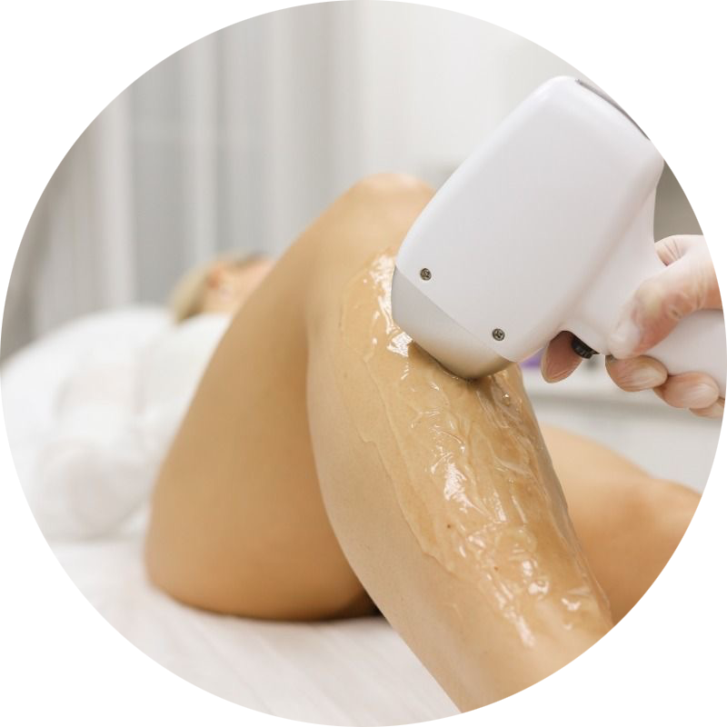 Lézeres Szőrtelenités