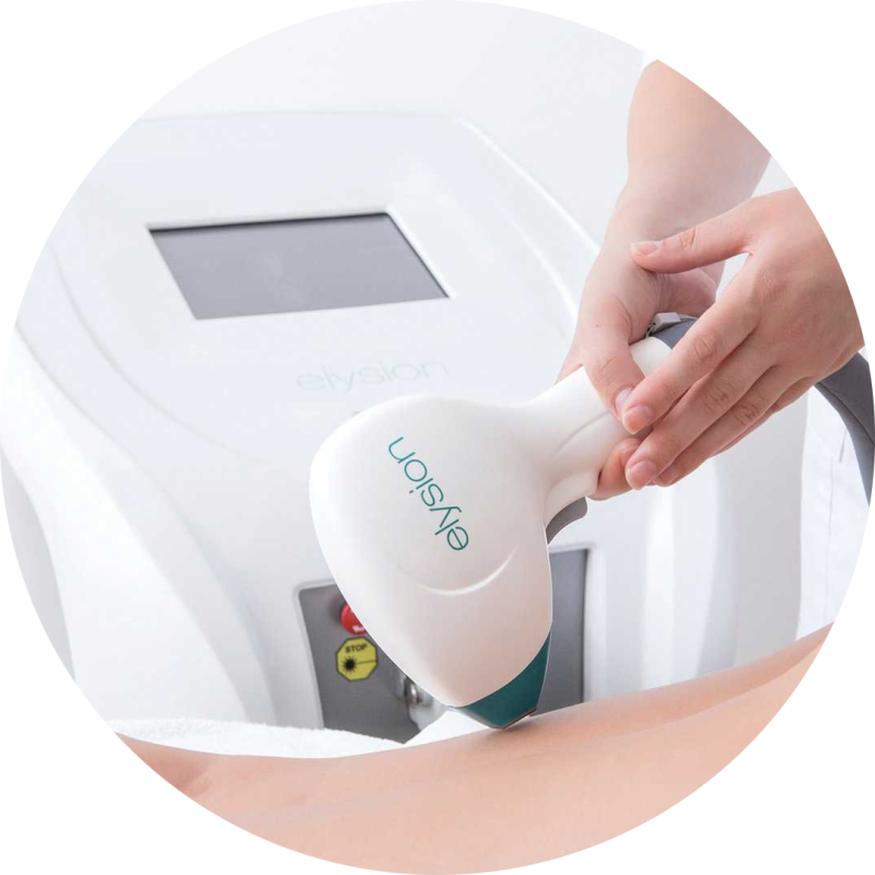 Lézeres Szőrtelenítés